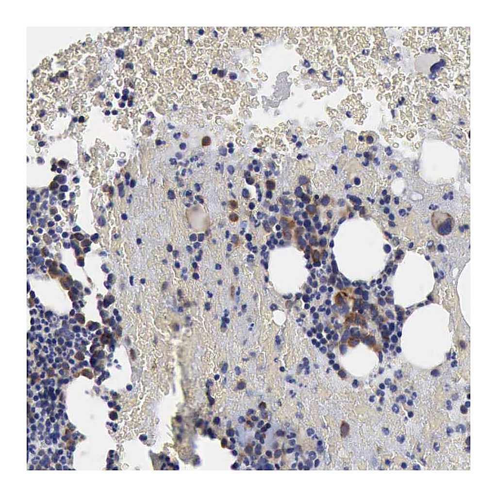Atlas Antibodies Anti-TXLNG Antibody