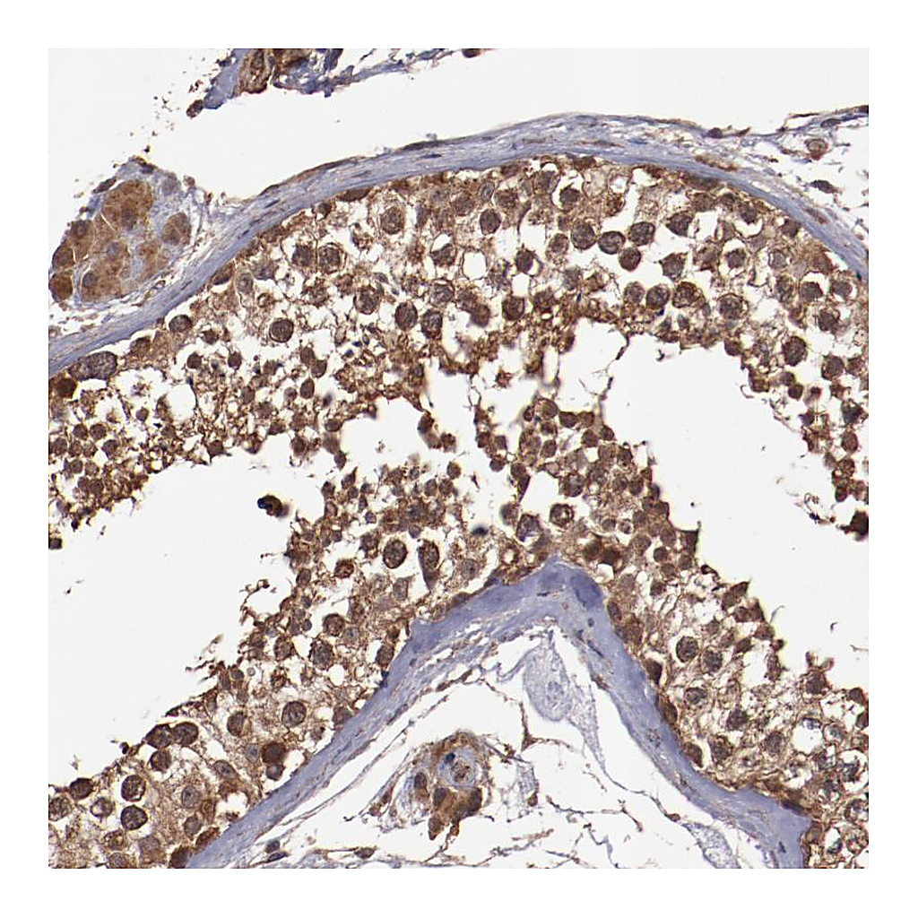 Atlas Antibodies Anti-TXNDC16 Antibody