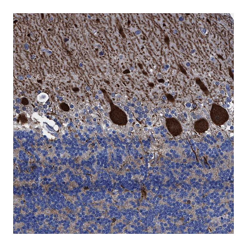 Atlas Antibodies Anti-TXNDC17 Antibody