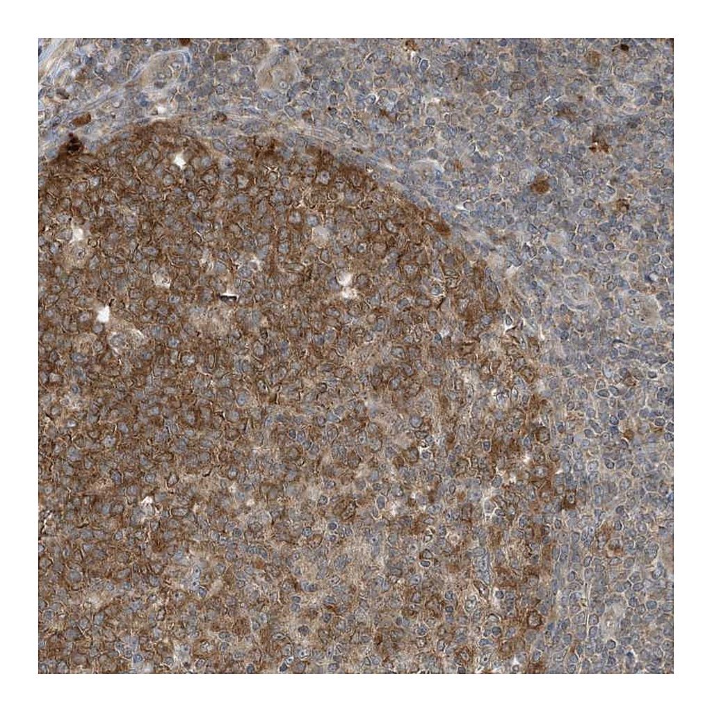 Atlas Antibodies Anti-TXNDC9 Antibody