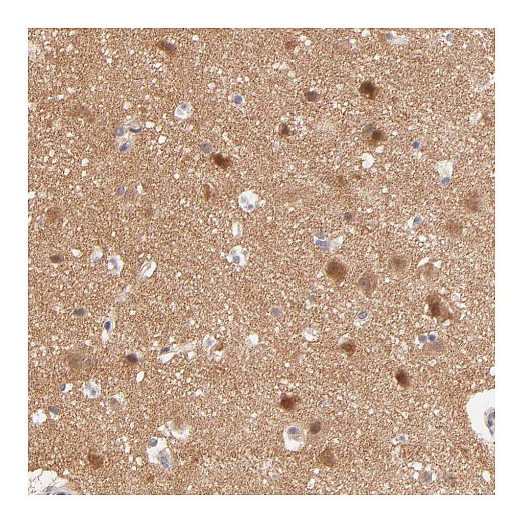 Atlas Antibodies Anti-TXNL1 Antibody