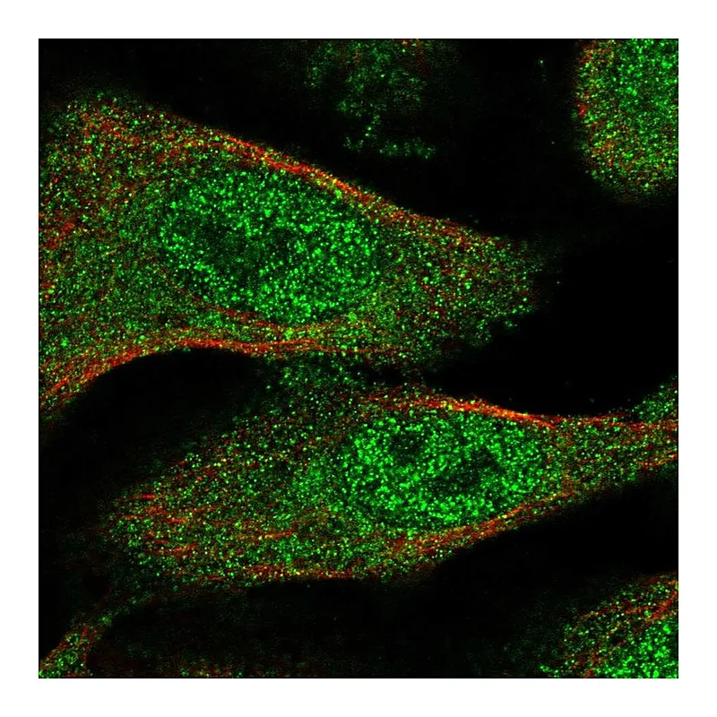 Atlas Antibodies Anti-TXNL4B Antibody