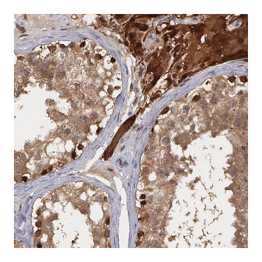 Atlas Antibodies Anti-TXNRD1 Antibody