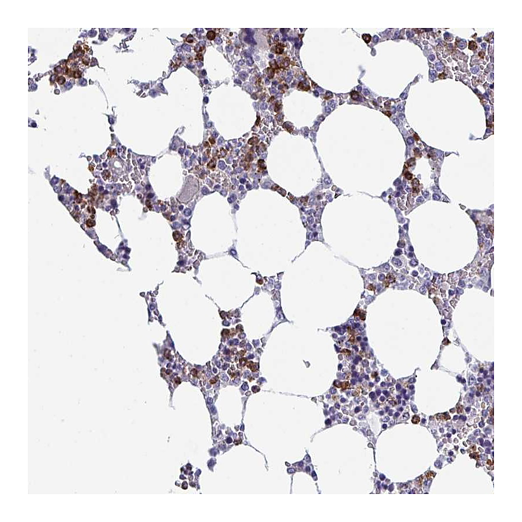 Atlas Antibodies Anti-TXNRD3NB Antibody
