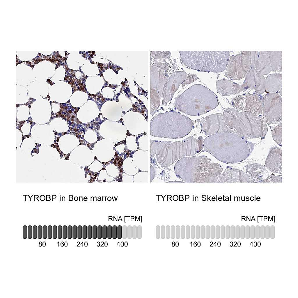 Atlas Antibodies Anti-TYROBP Antibody