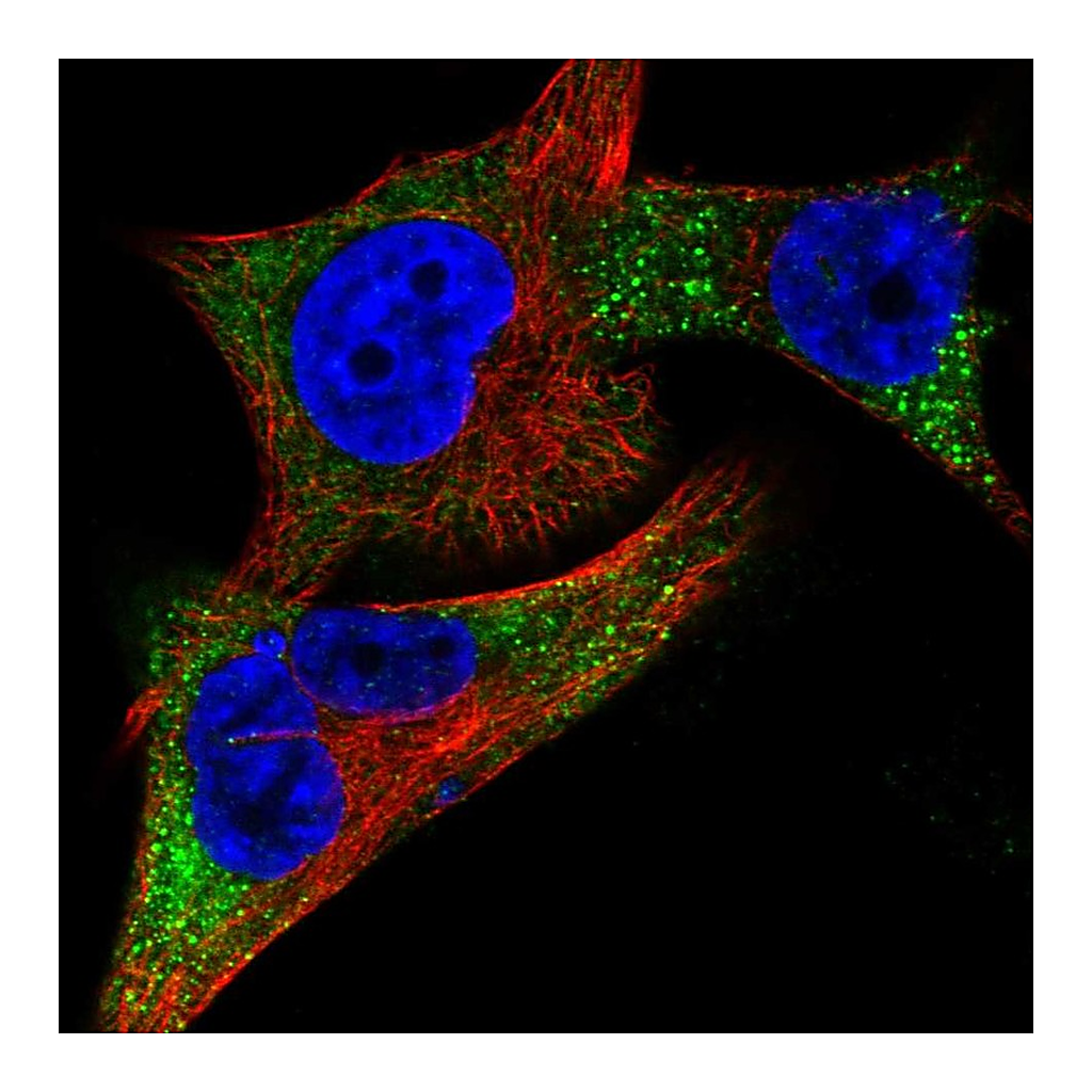 Atlas Antibodies Anti-TYR Antibody