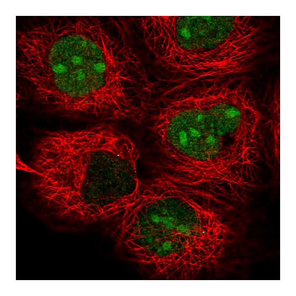 Atlas Antibodies Anti-TYW1 Antibody