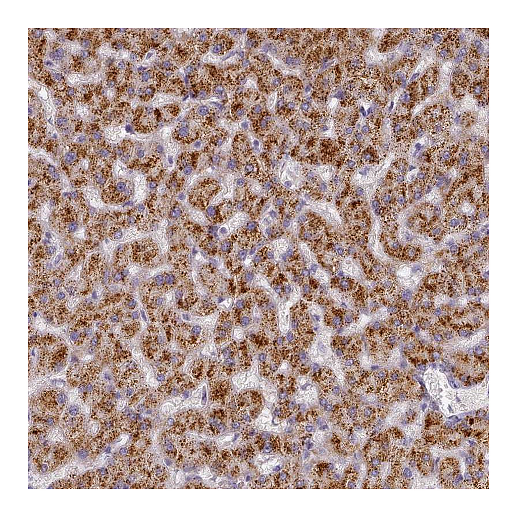 Atlas Antibodies Anti-TYW1B Antibody