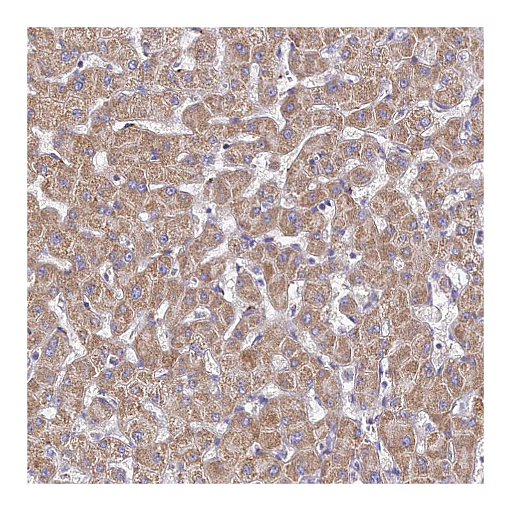 Atlas Antibodies Anti-TYW5 Antibody