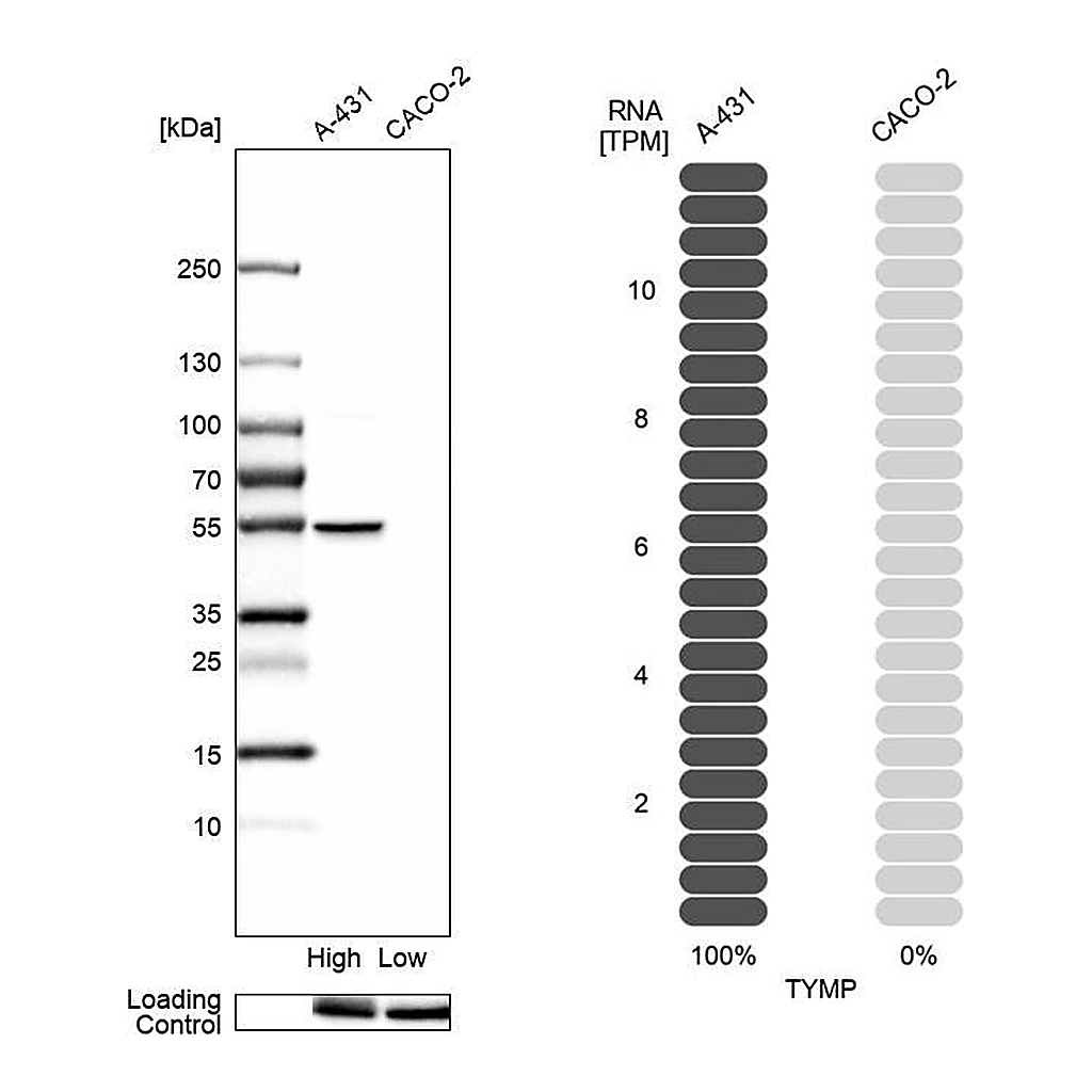 Atlas Antibodies Anti-TYMP Antibody