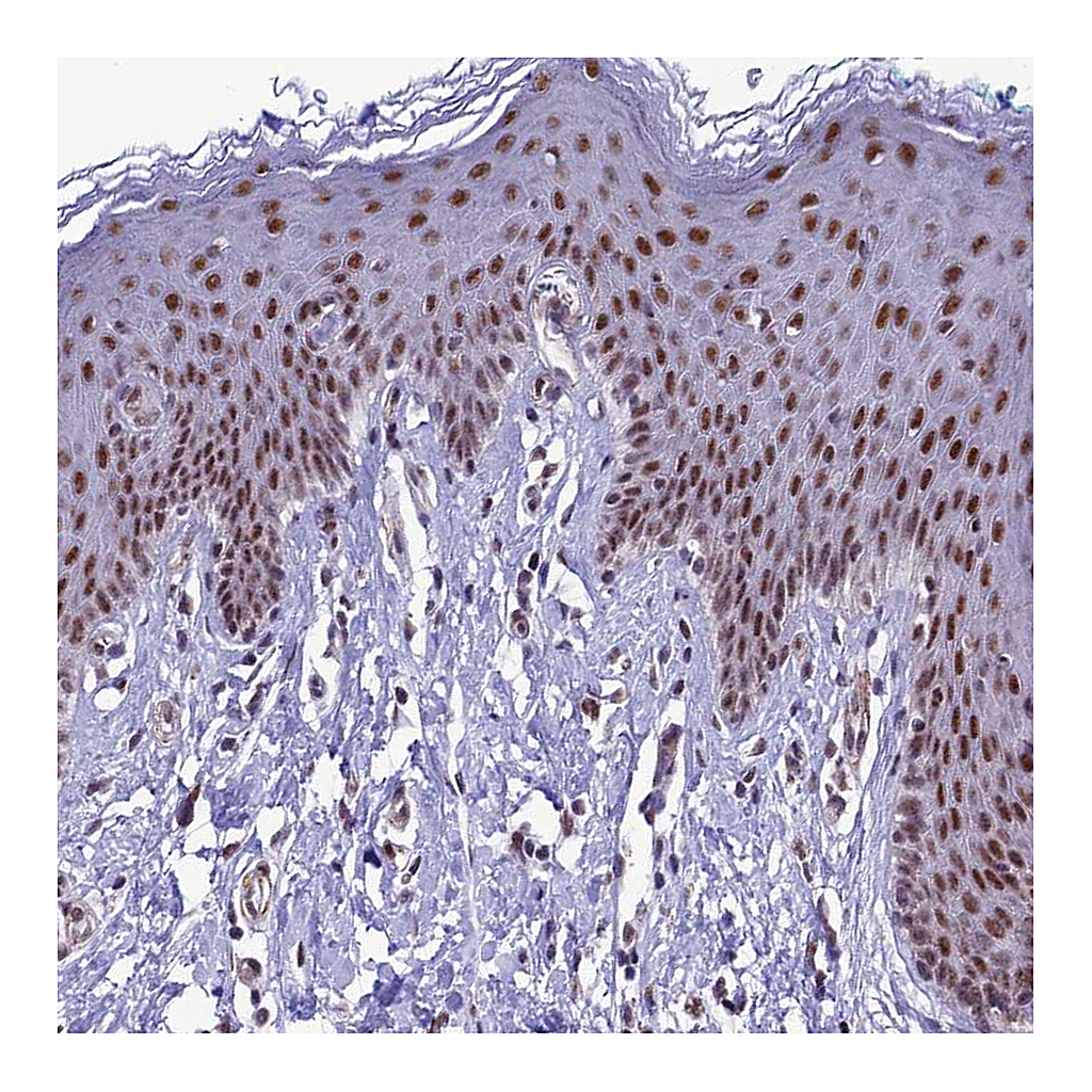 Atlas Antibodies Anti-U2AF1 Antibody
