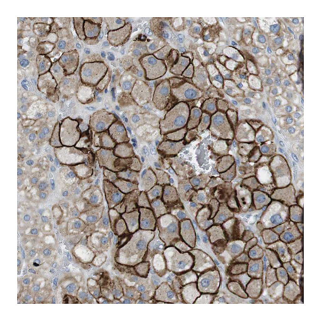 Atlas Antibodies Anti-TYW1 Antibody