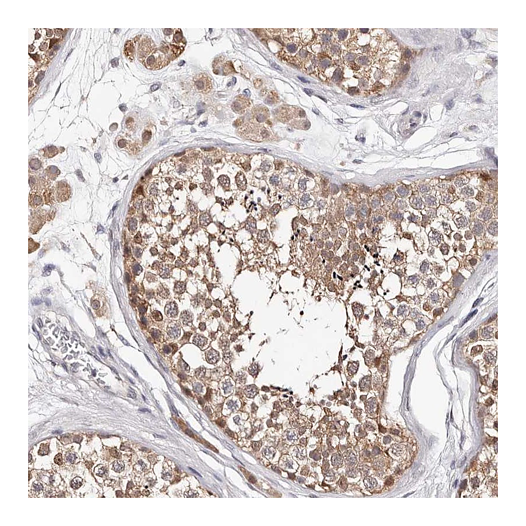 Atlas Antibodies Anti-TYW3 Antibody