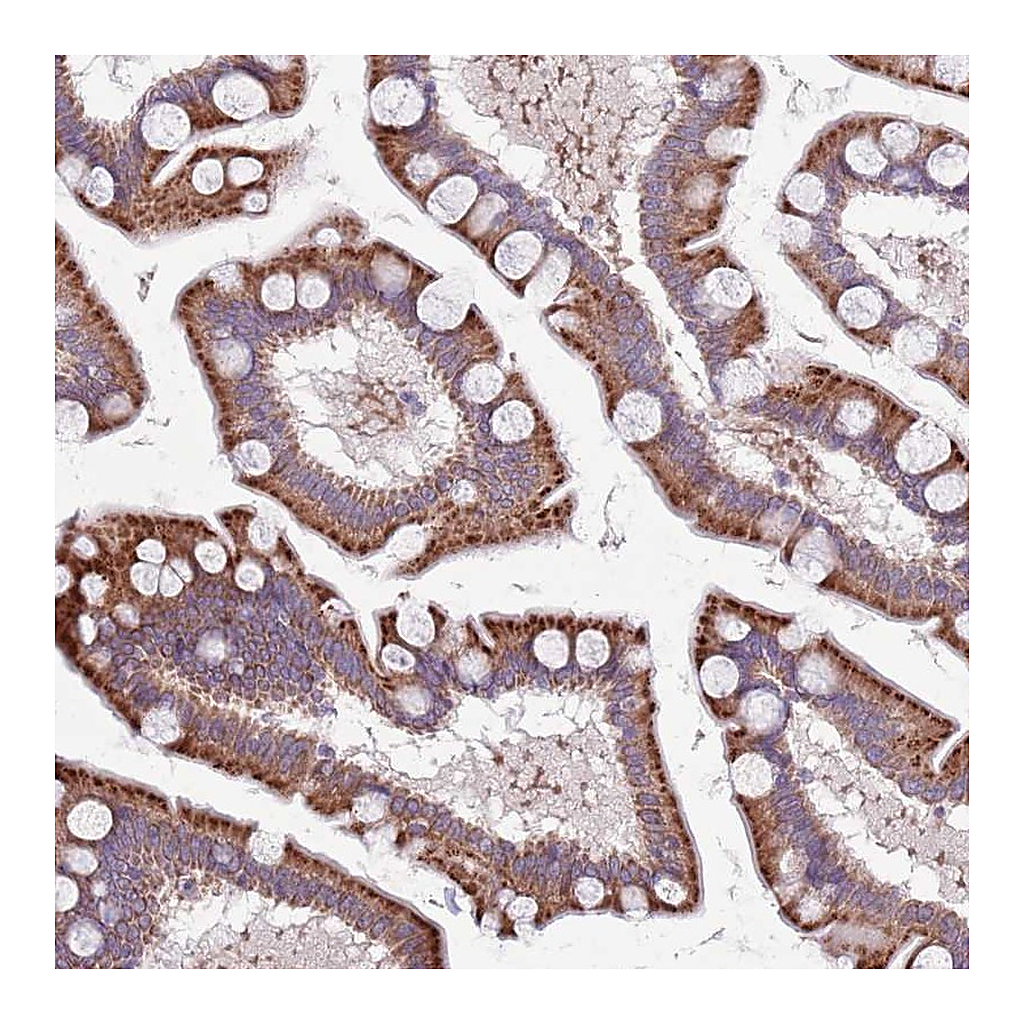 Atlas Antibodies Anti-TYW1 Antibody