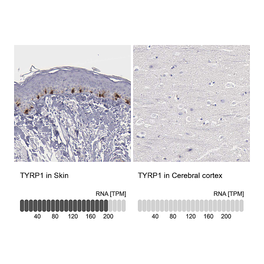Atlas Antibodies Anti-TYRP1 Antibody