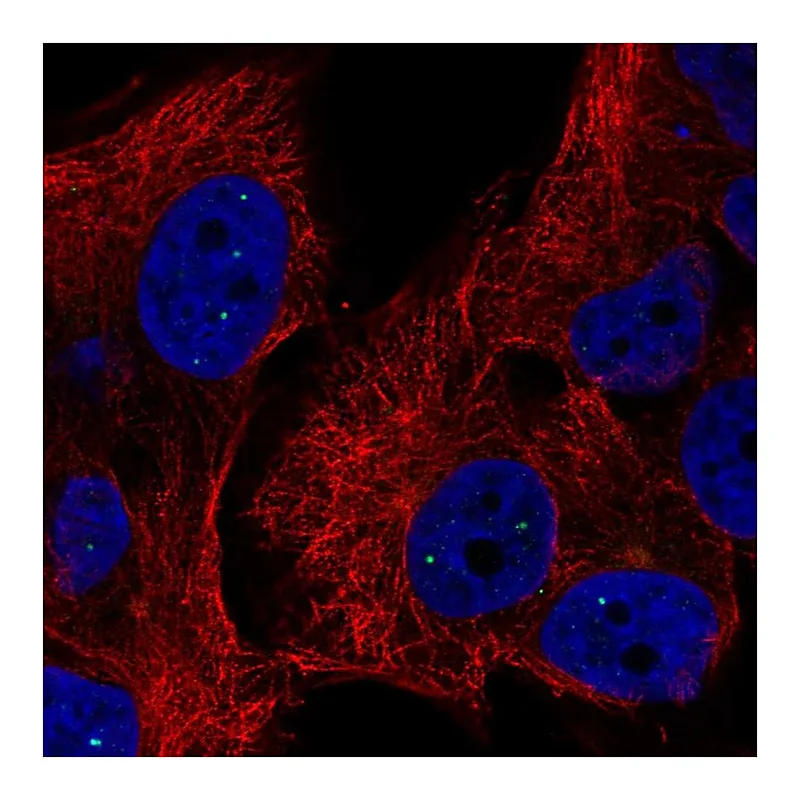 Atlas Antibodies Anti-TYW5 Antibody