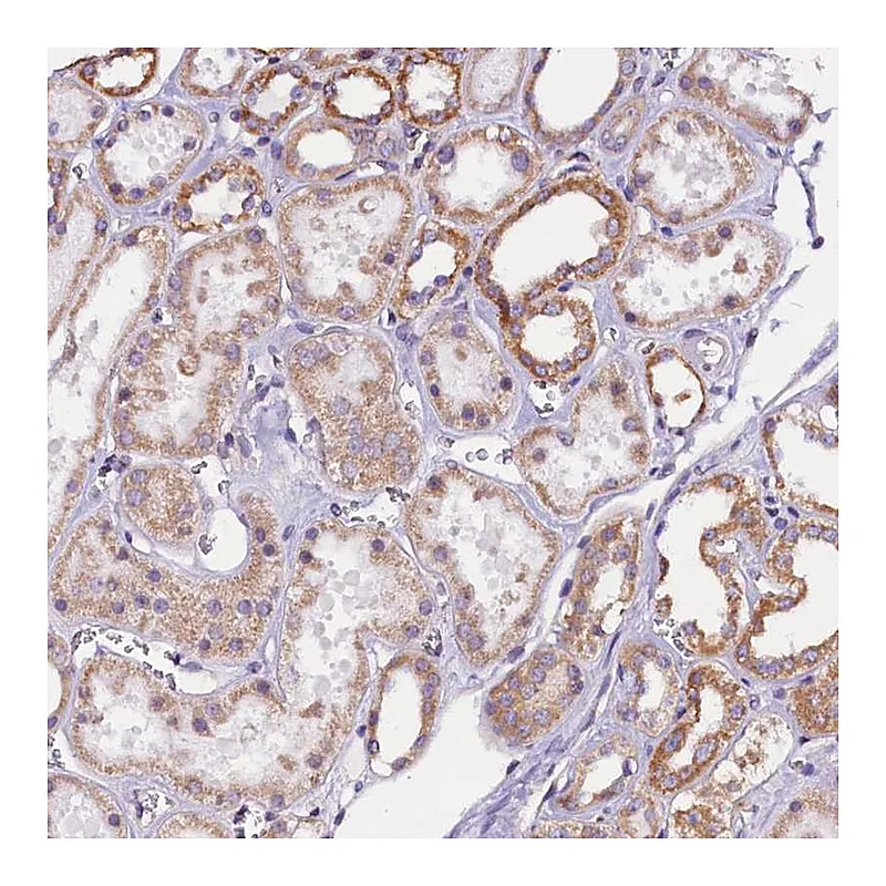 Atlas Antibodies Anti-UACA Antibody