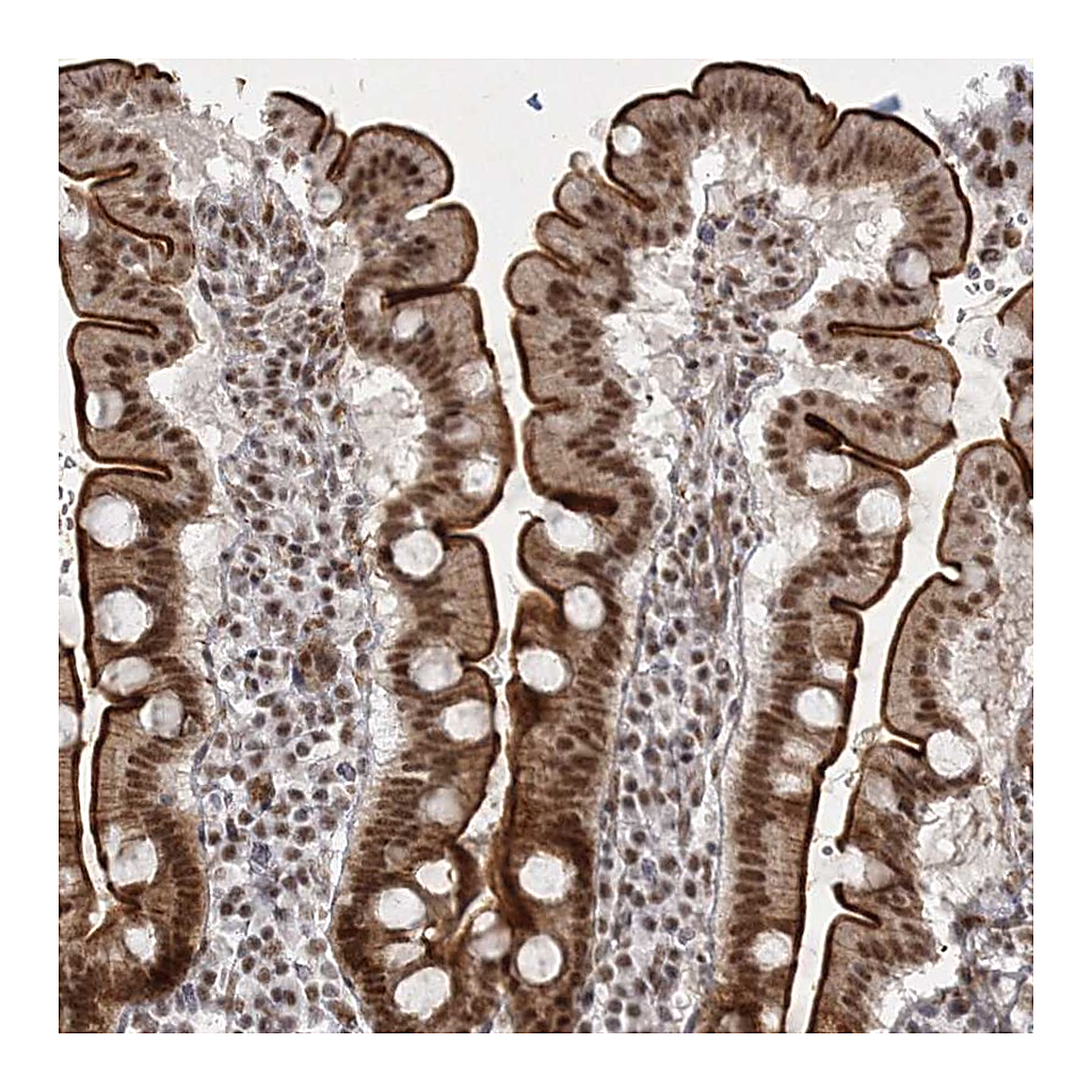 Atlas Antibodies Anti-U2SURP Antibody