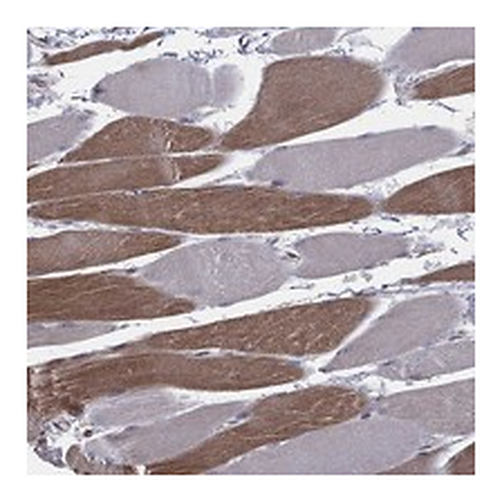 Atlas Antibodies Anti-UACA Antibody