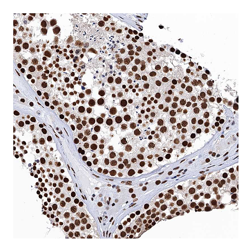 Atlas Antibodies Anti-UBA2 Antibody