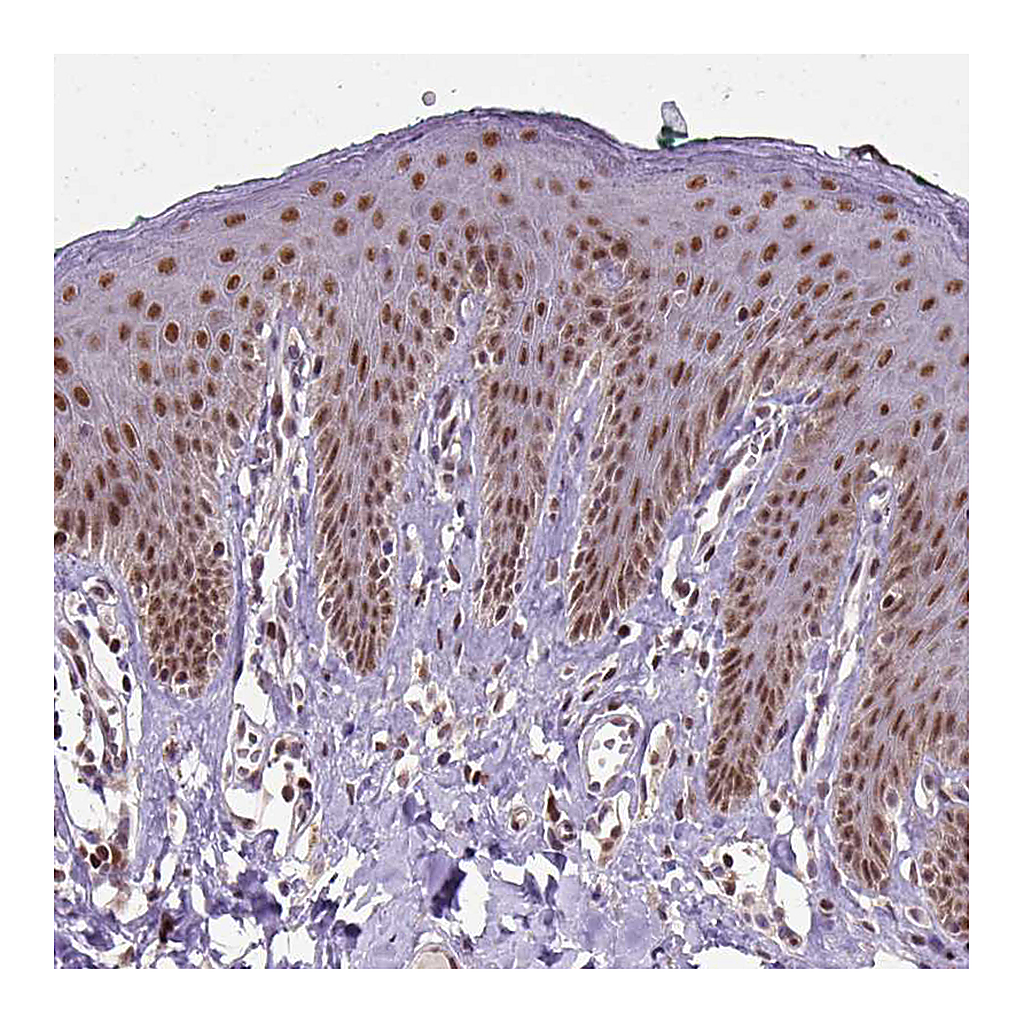Atlas Antibodies Anti-UBA3 Antibody