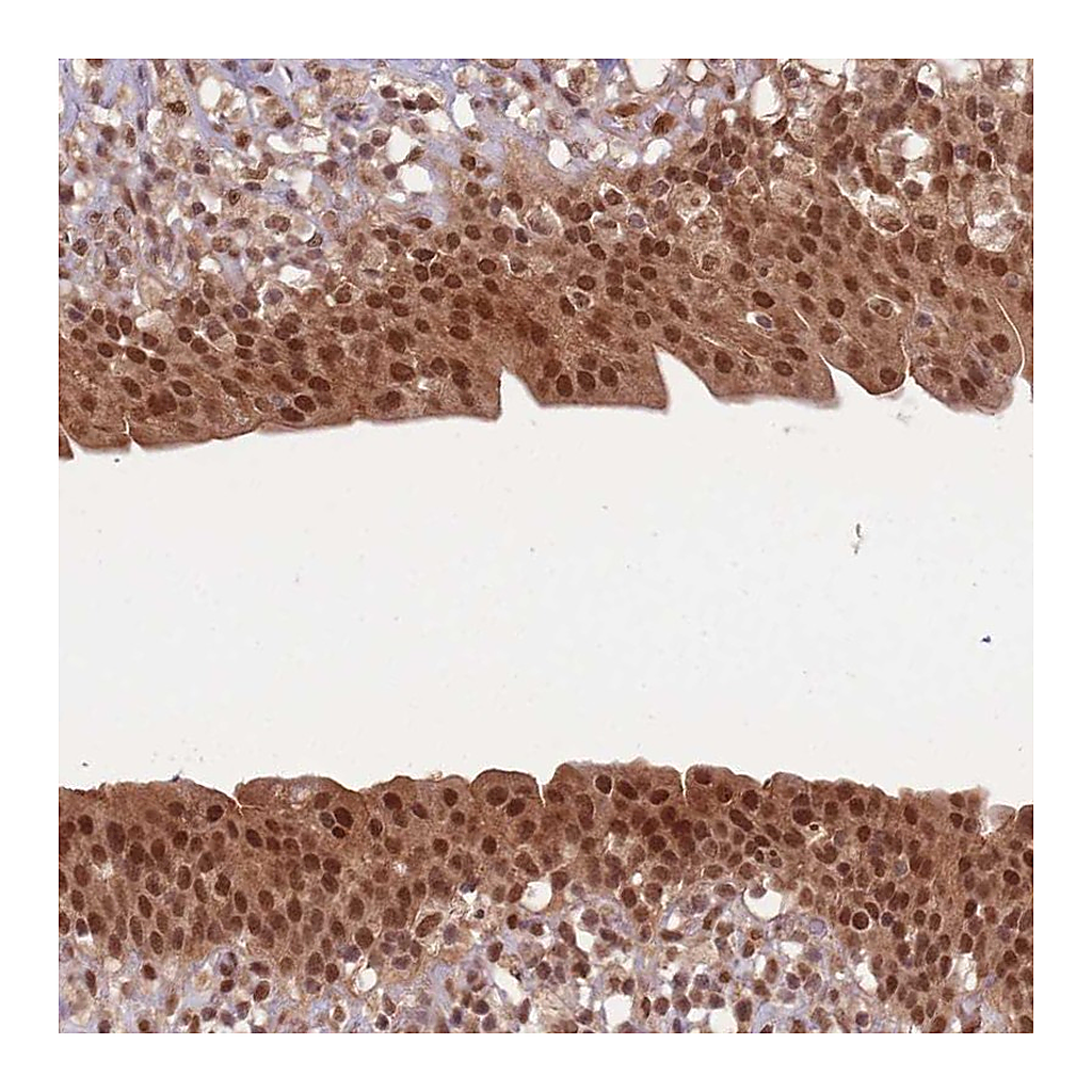 Atlas Antibodies Anti-UBB Antibody