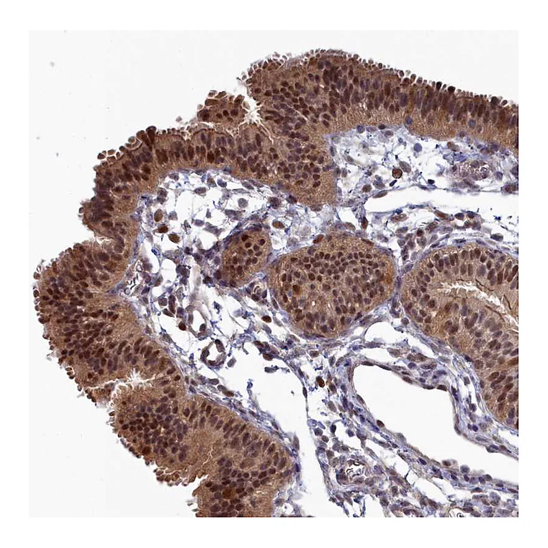 Atlas Antibodies Anti-UBC Antibody