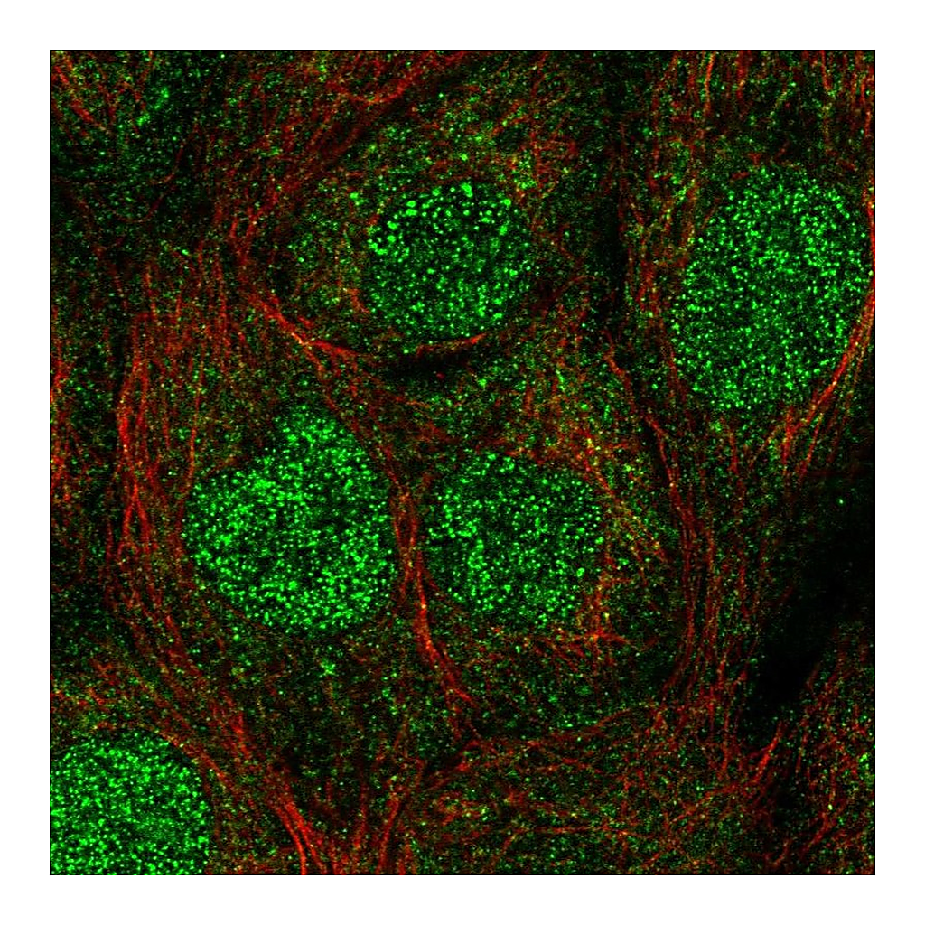 Atlas Antibodies Anti-UBE2A Antibody
