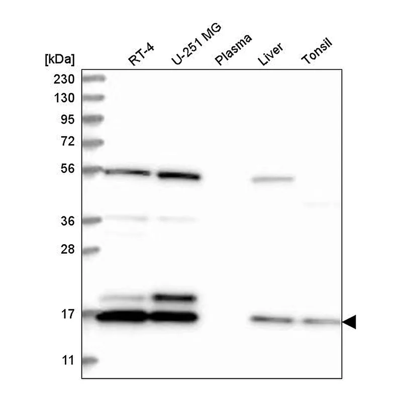 Atlas Antibodies Anti-UBE2C Antibody