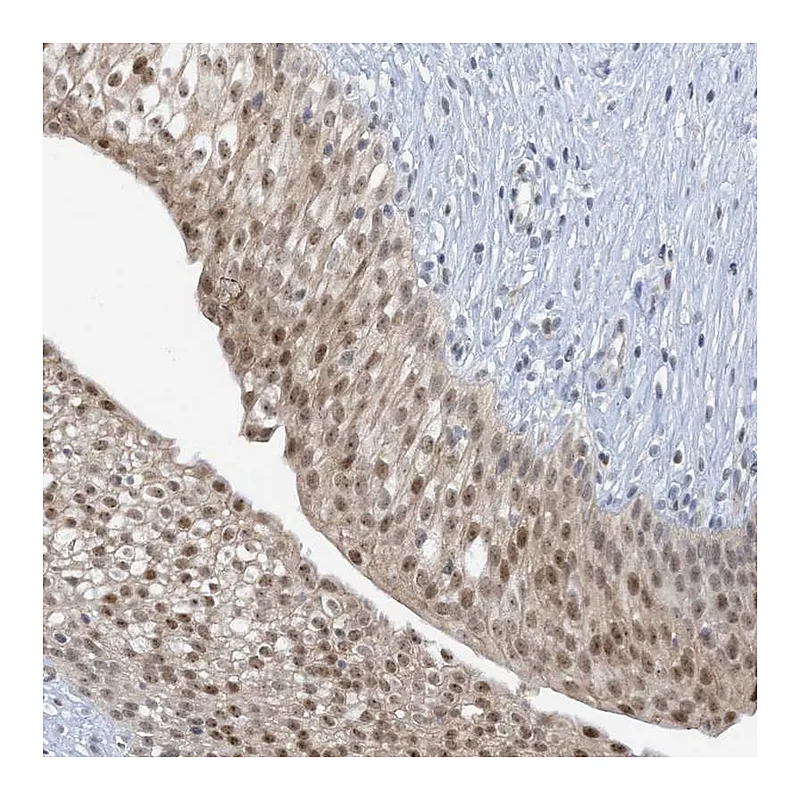 Atlas Antibodies Anti-UBE2E1 Antibody