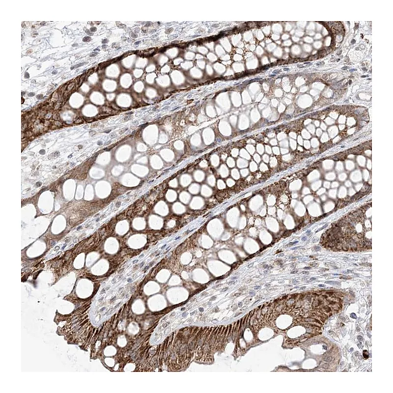 Atlas Antibodies Anti-UBE2E2 Antibody