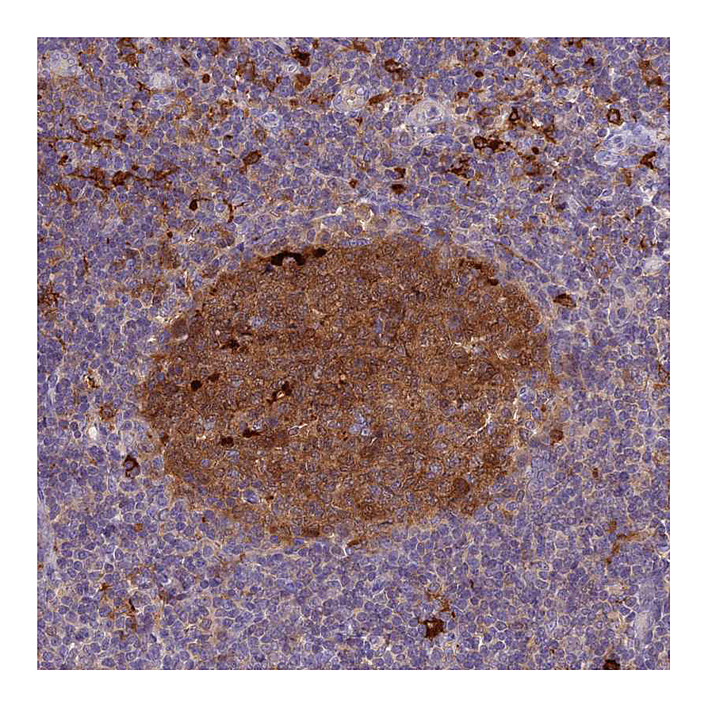 Atlas Antibodies Anti-UBE2G1 Antibody