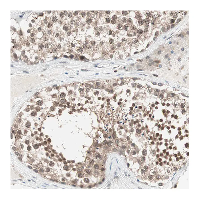 Atlas Antibodies Anti-UBE2I Antibody