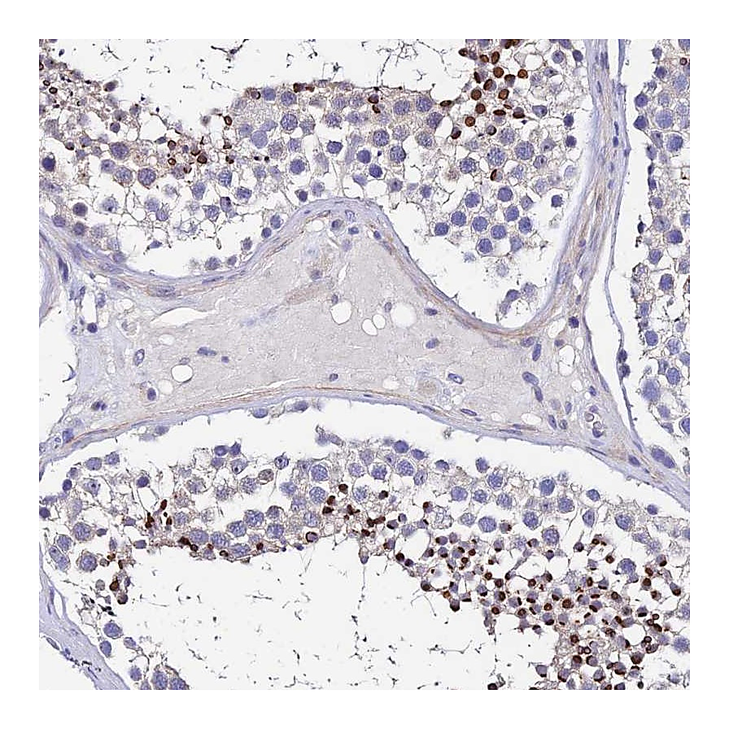 Atlas Antibodies Anti-UBE2L3 Antibody