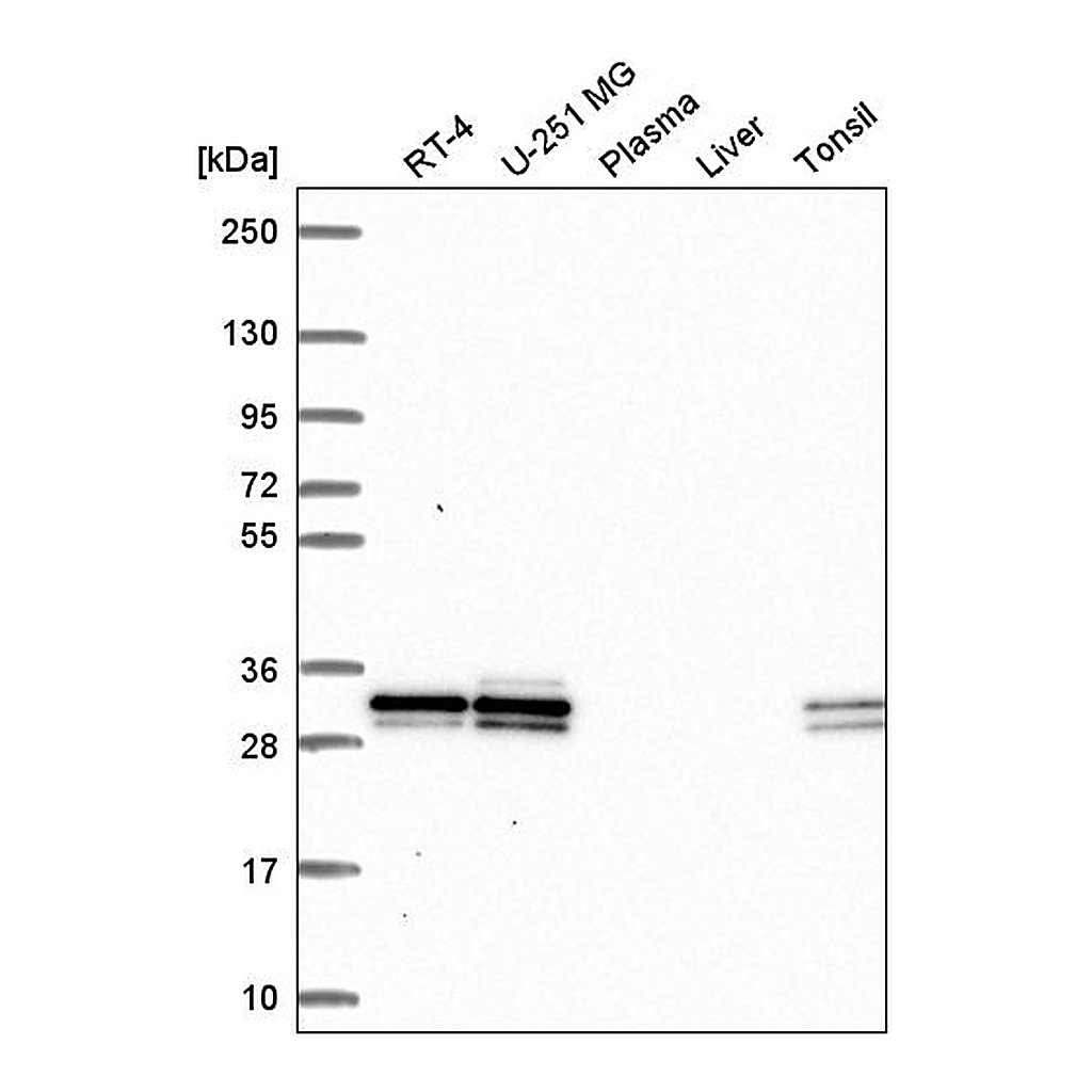 Atlas Antibodies Anti-UBE2R2 Antibody