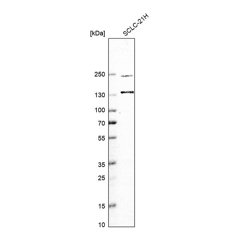 Atlas Antibodies Anti-UBE2O Antibody