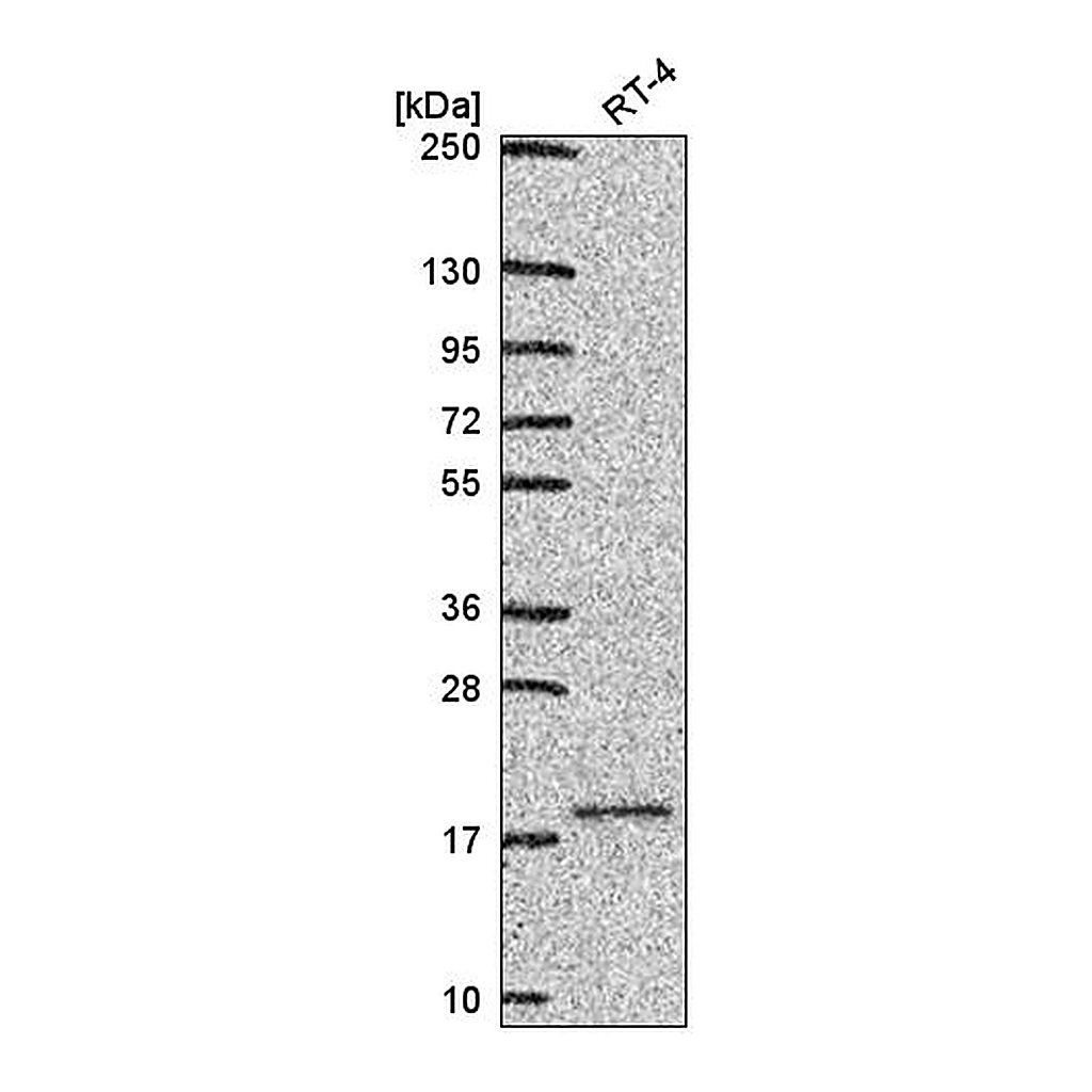 Atlas Antibodies Anti-UBE2V1 Antibody