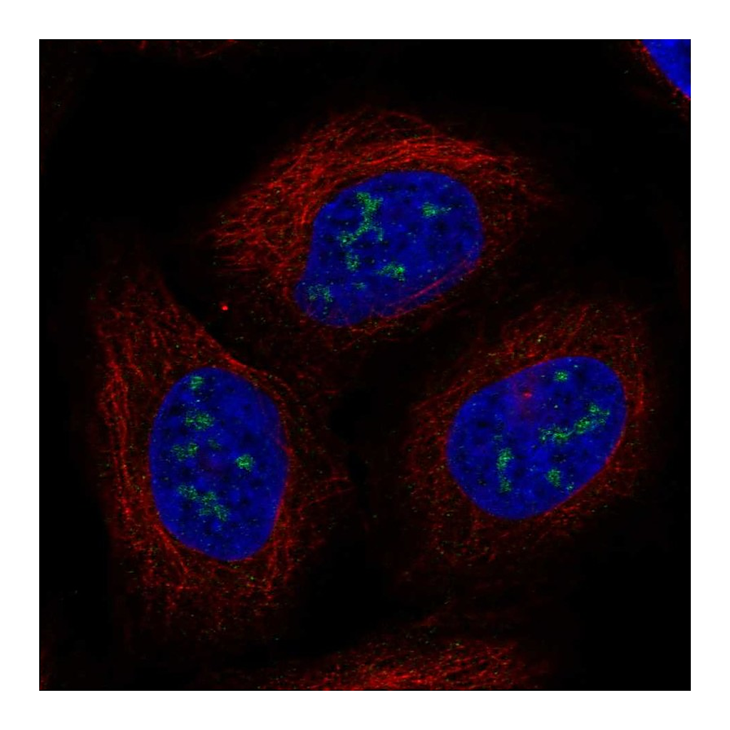 Atlas Antibodies Anti-UBE2W Antibody