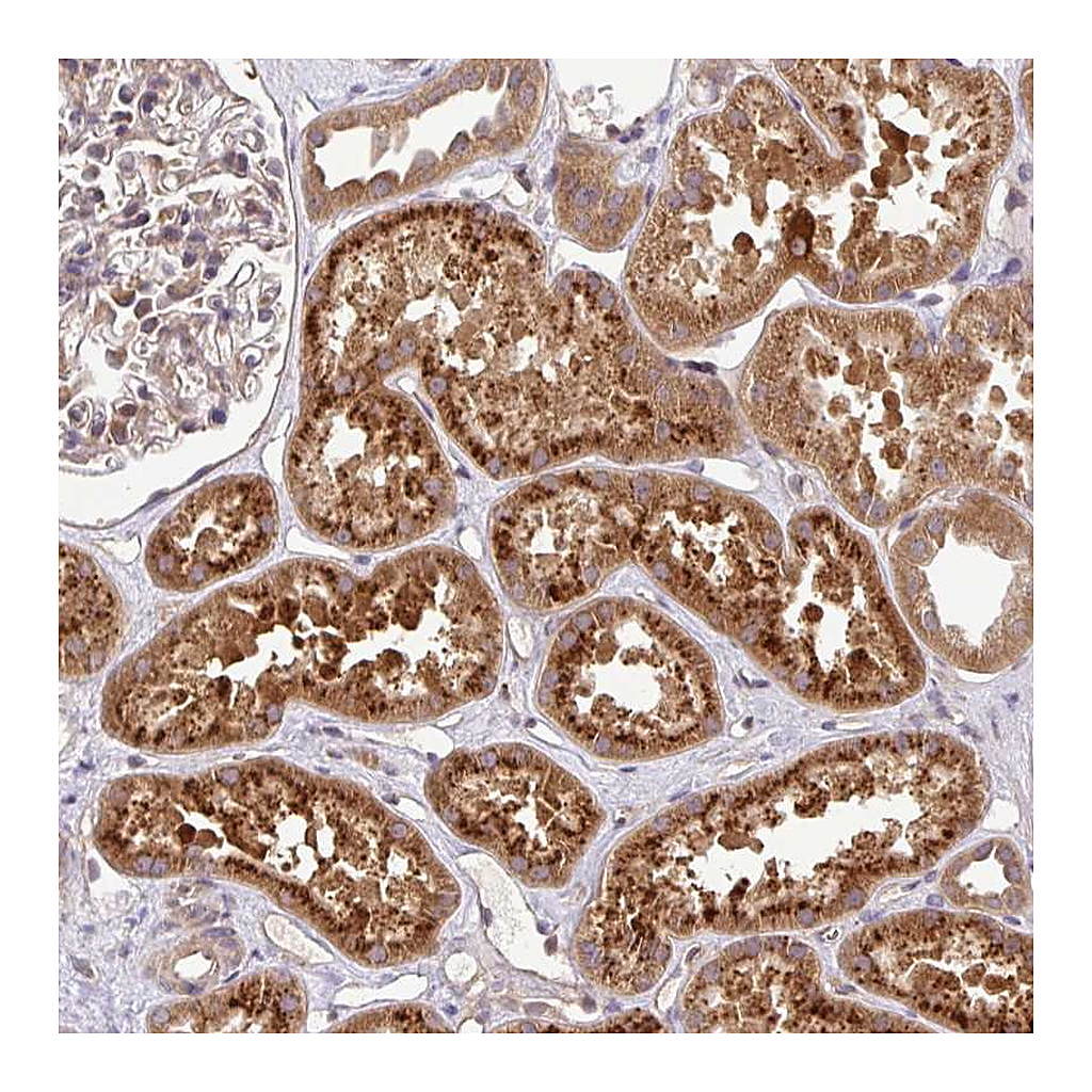 Atlas Antibodies Anti-UBE4A Antibody