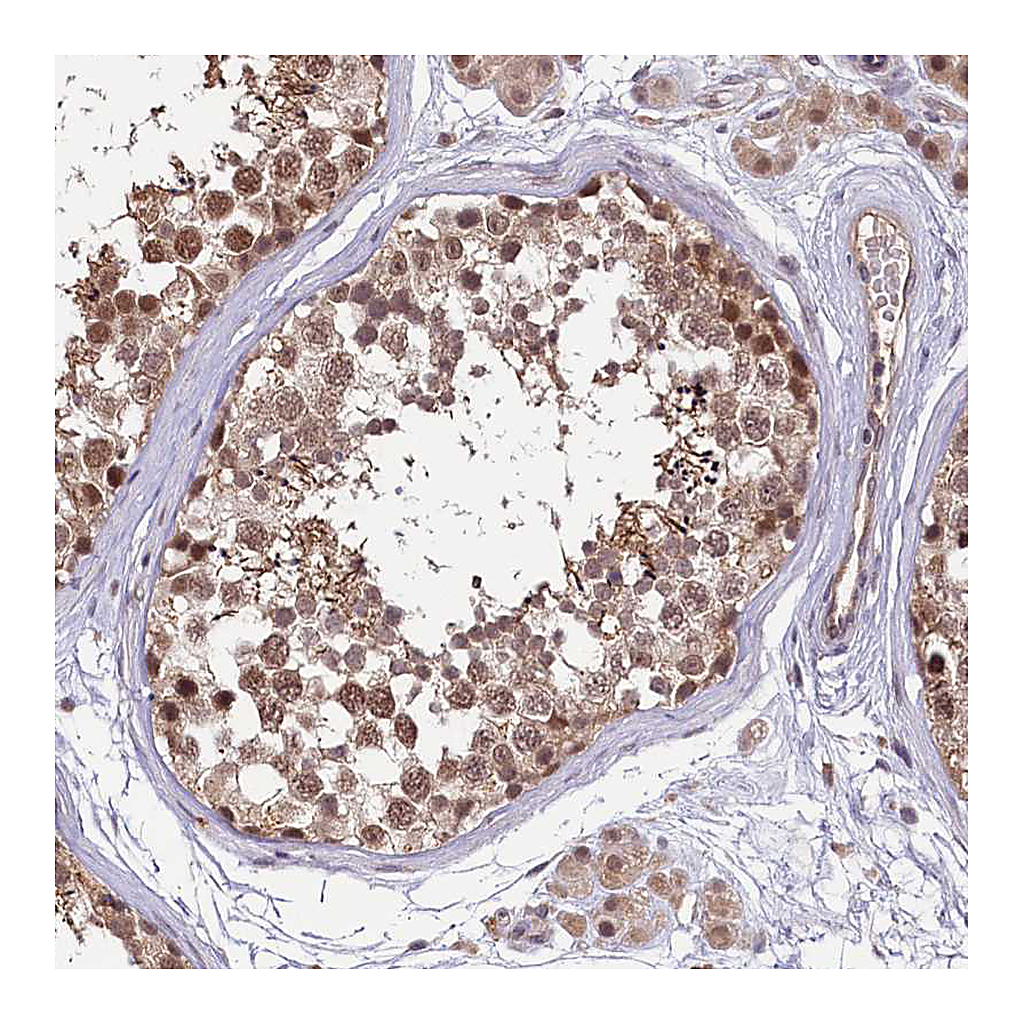 Atlas Antibodies Anti-UBE3A Antibody