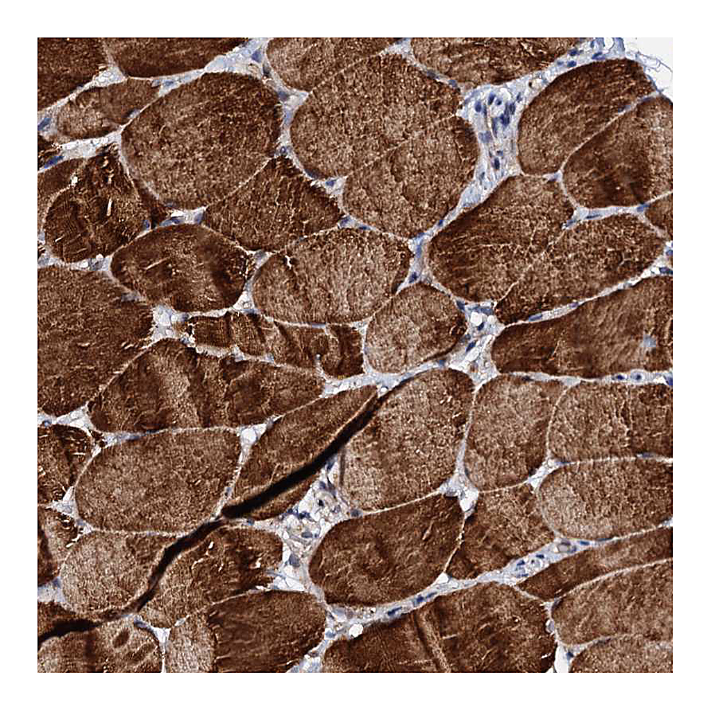 Atlas Antibodies Anti-UBE3C Antibody