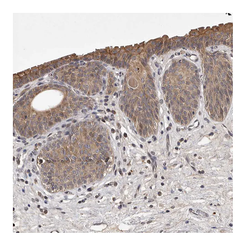 Atlas Antibodies Anti-UBE3D Antibody