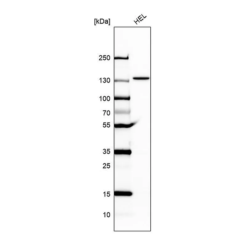 Atlas Antibodies Anti-UBE4A Antibody