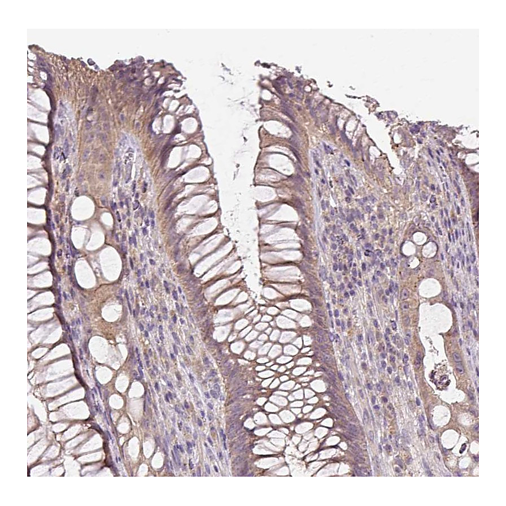 Atlas Antibodies Anti-UBL3 Antibody