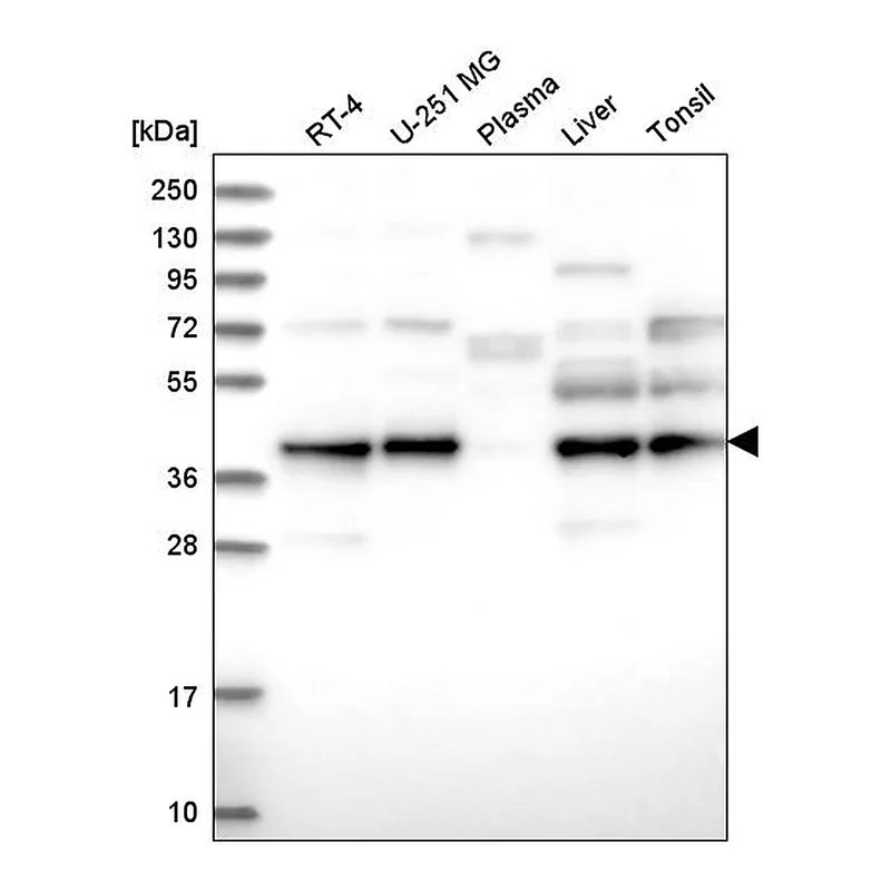 Atlas Antibodies Anti-UBL7 Antibody