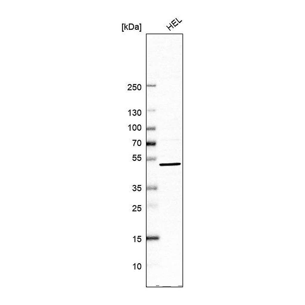 Atlas Antibodies Anti-UBP1 Antibody