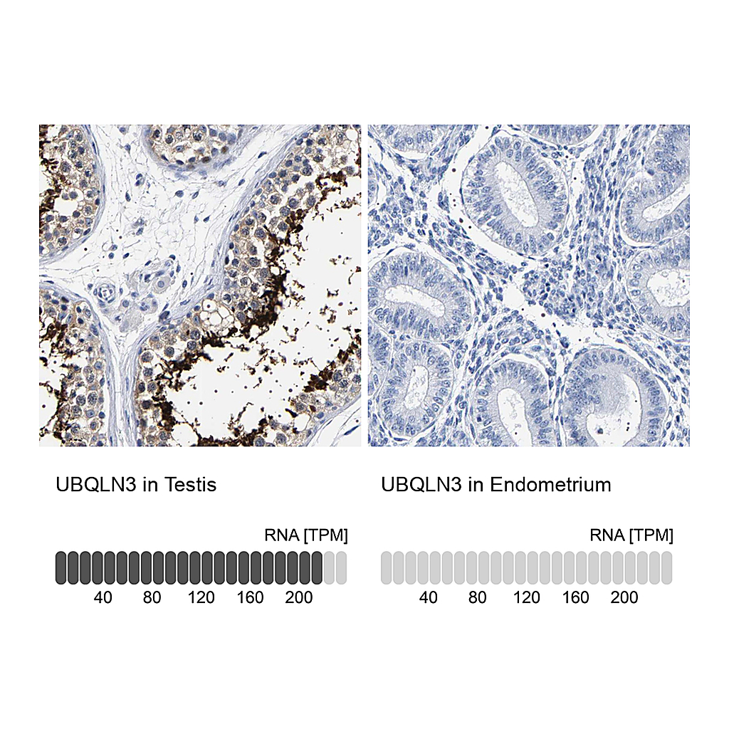Atlas Antibodies Anti-UBQLN3 Antibody
