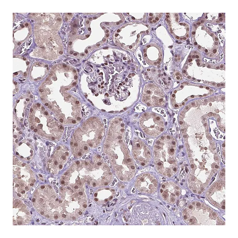 Atlas Antibodies Anti-UBQLN4 Antibody