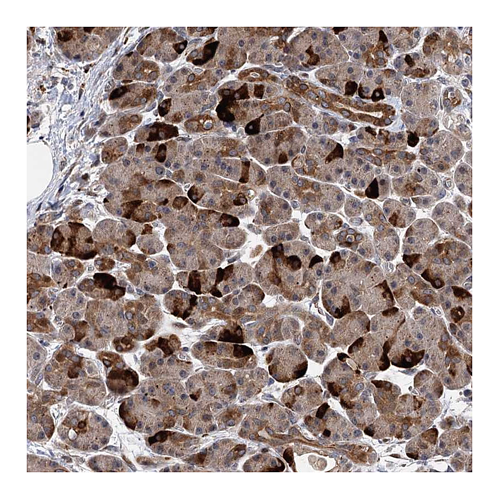 Atlas Antibodies Anti-UBR1 Antibody