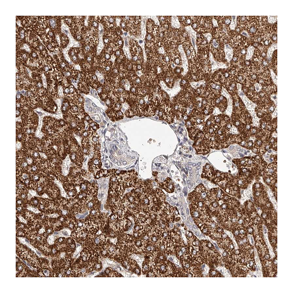 Atlas Antibodies Anti-UBR2 Antibody
